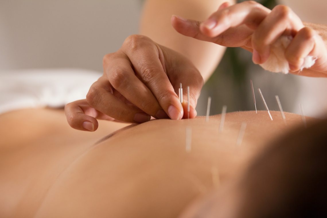 what is acupuncture used to treat