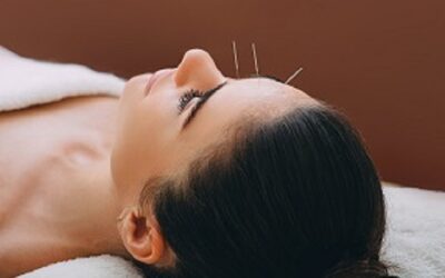 What Does Facial Acupuncture Do? Think of It as a Natural Way to Look Younger