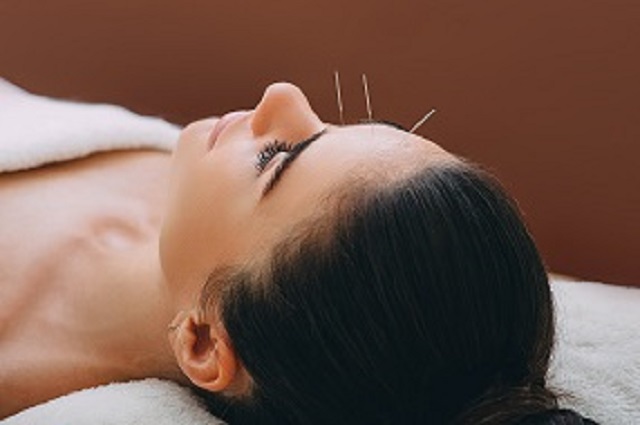 woman receiving facial acupuncture