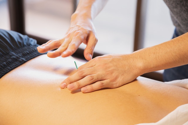 Dry needling vs. acupuncture - which one will treat your condition best?