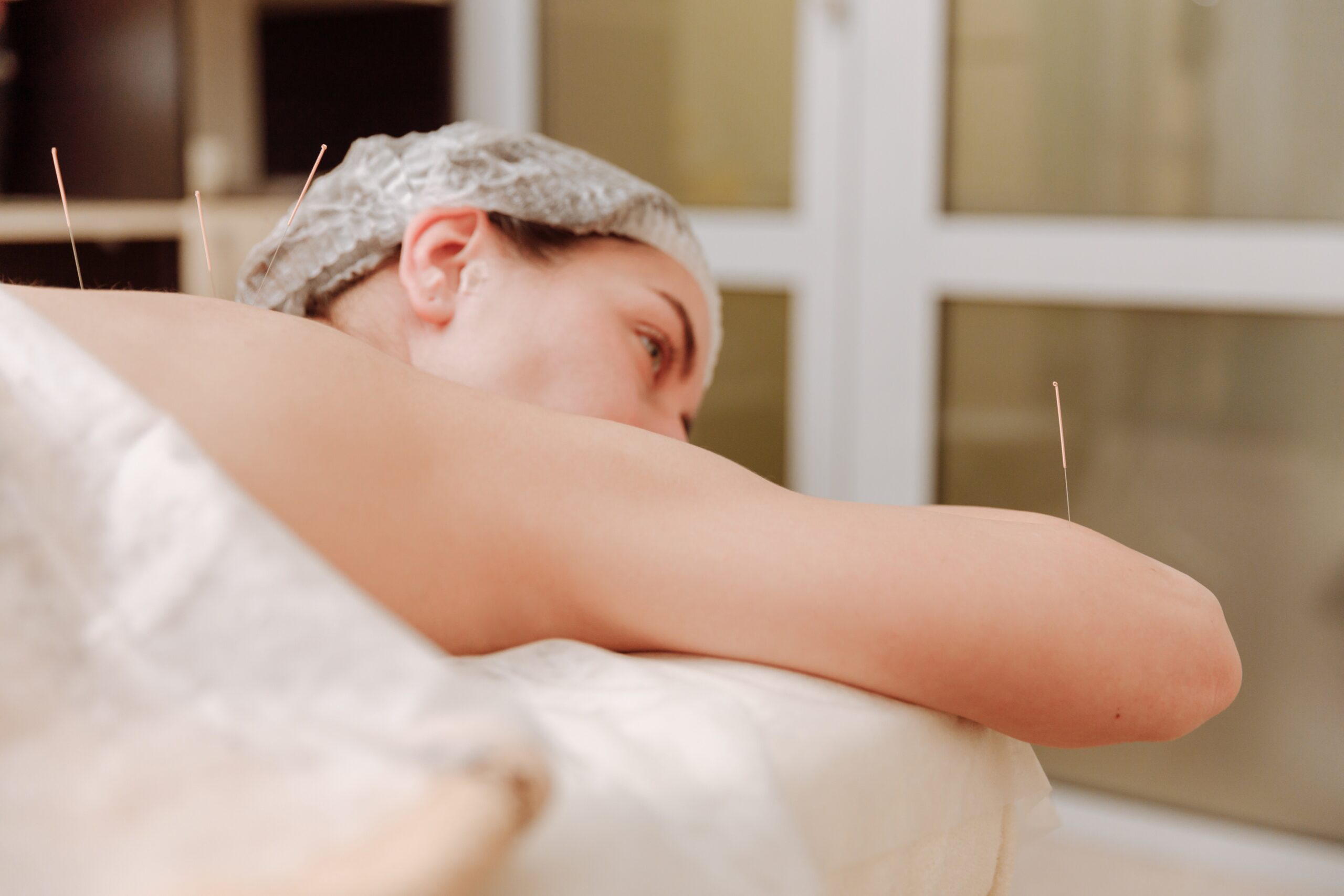 can acupuncture help with depression